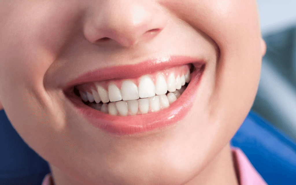 What is Dental Implant?