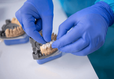 Understanding the Different Types of Dental Crowns! Understanding the Different Types of Dental Crowns!