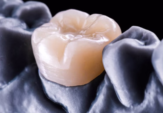 dental crowns
